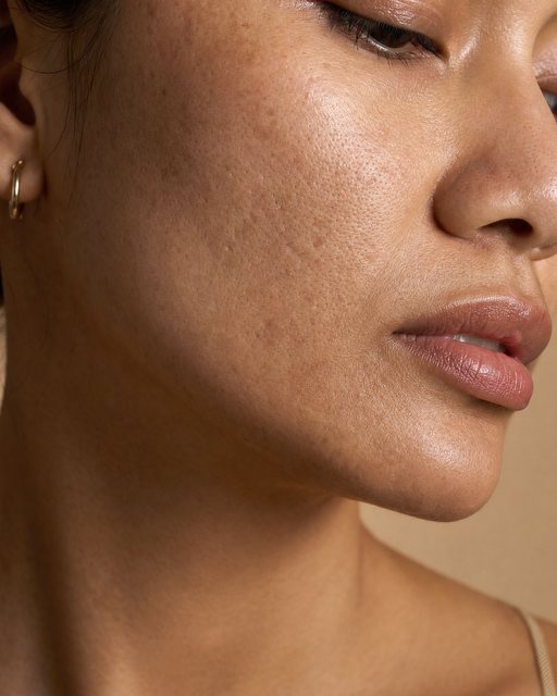 Dermabrasion